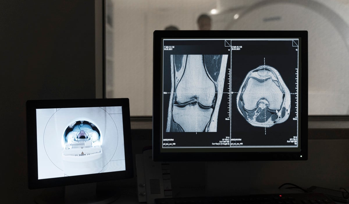 Bild på röntgenbilder som analyseras på dator