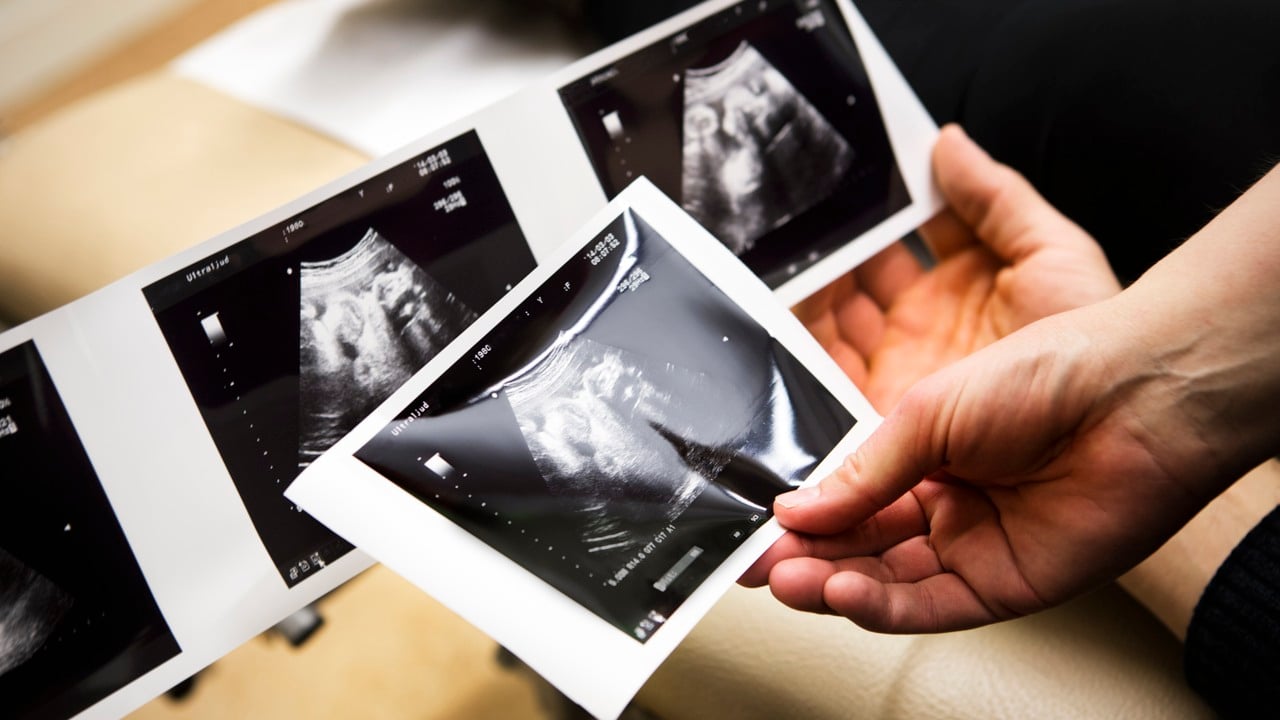 Två händer som håller i ultraljudsbilder