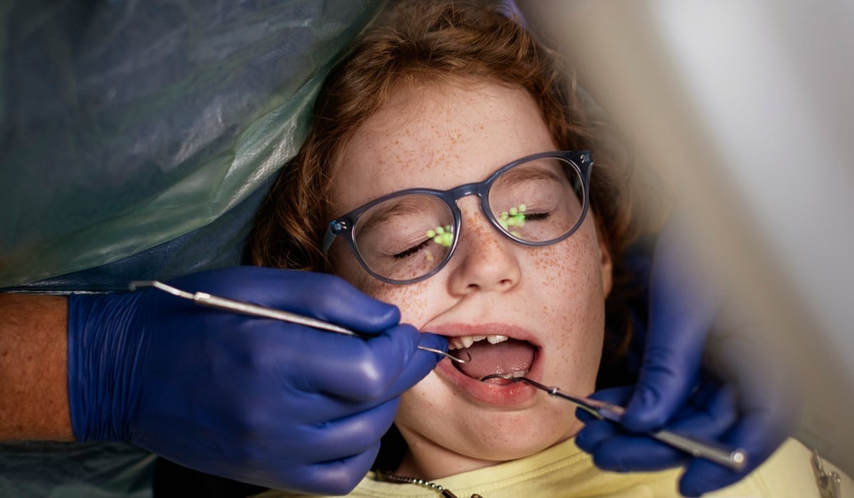 Närbild på ett barn som blir undersökt hos tandläkaren. 