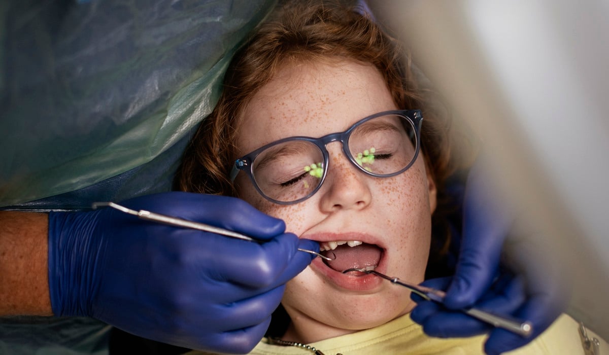 Närbild på ett barn som blir undersökt hos tandläkaren.