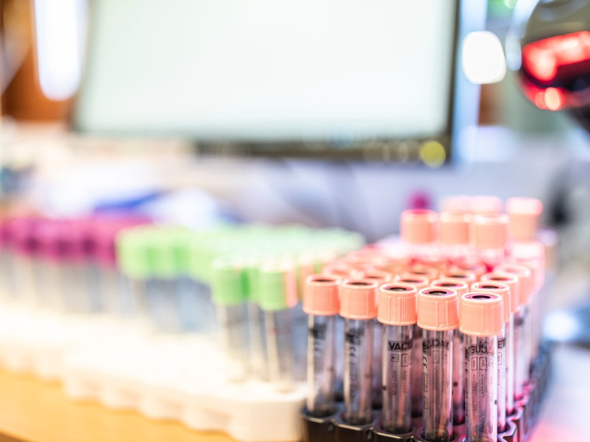 Flera provrör i ett laboratorium