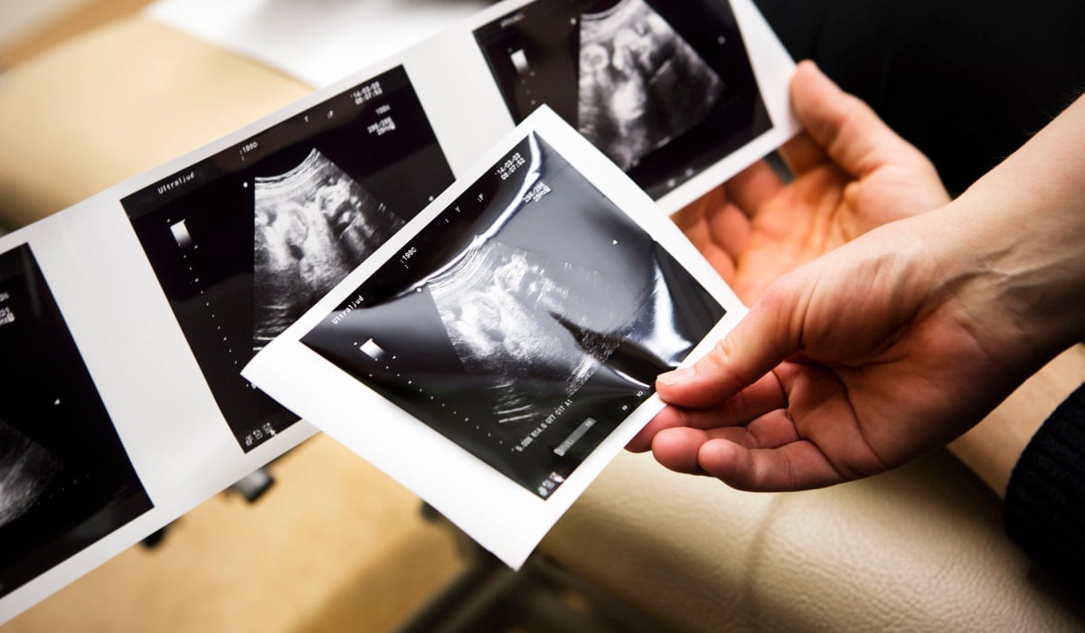 En person som håller en bild av en bebis i sina händer.